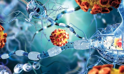 Autoimmune Disorders Treatment in Nagpur