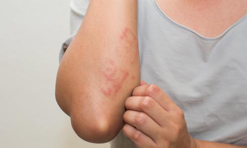Autoinflammatory Disorders Treatment in Nagpur
