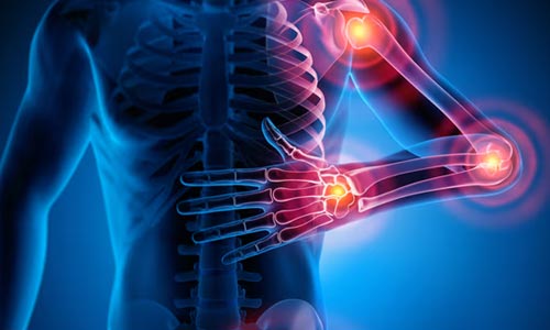 Soft Tissue Rheumatism Treatment in Nagpur