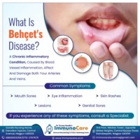 Bechet Disease Treatment in Nagpur